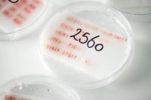 Petrischaal met 2560 zorgvuldig verzamelde haarfollikel-grafts, genummerd voor nauwkeurige registratie en gebruik tijdens een haartransplantatie.