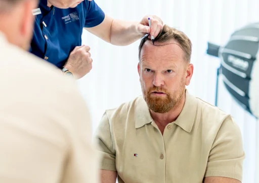 Man overweegt haartransplantatie in Turkije of Nederland tijdens consult bij Nederlandse haartransplantatiekliniek