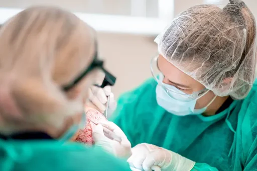 Twee chirurgen in groene operatiekleding voeren nauwgezet een haartransplantatie uit.