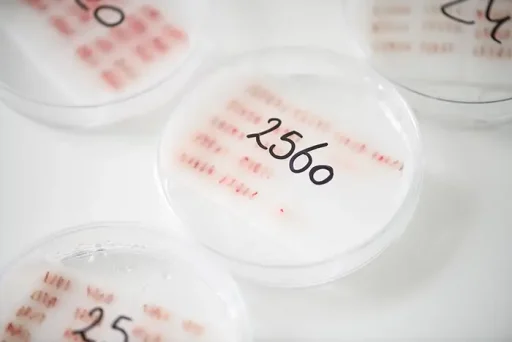 Petrischaaltjes met getelde grafts voor haartransplantatie met nummer 2560.