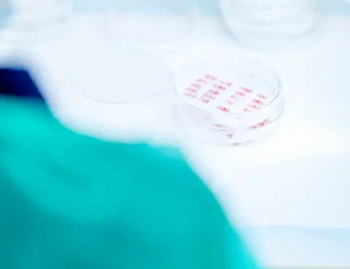 Vage close-up van petrischaaltjes met haargroeimiddelen en etiketten op een groene operatiedoek ter ondersteuning van een haartransplantatie.