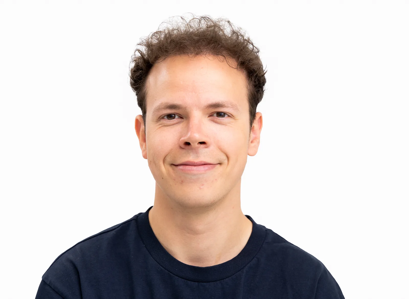 Jurrien Hendrikx after his hair transplant, with visibly improved hair density and restored hairline.