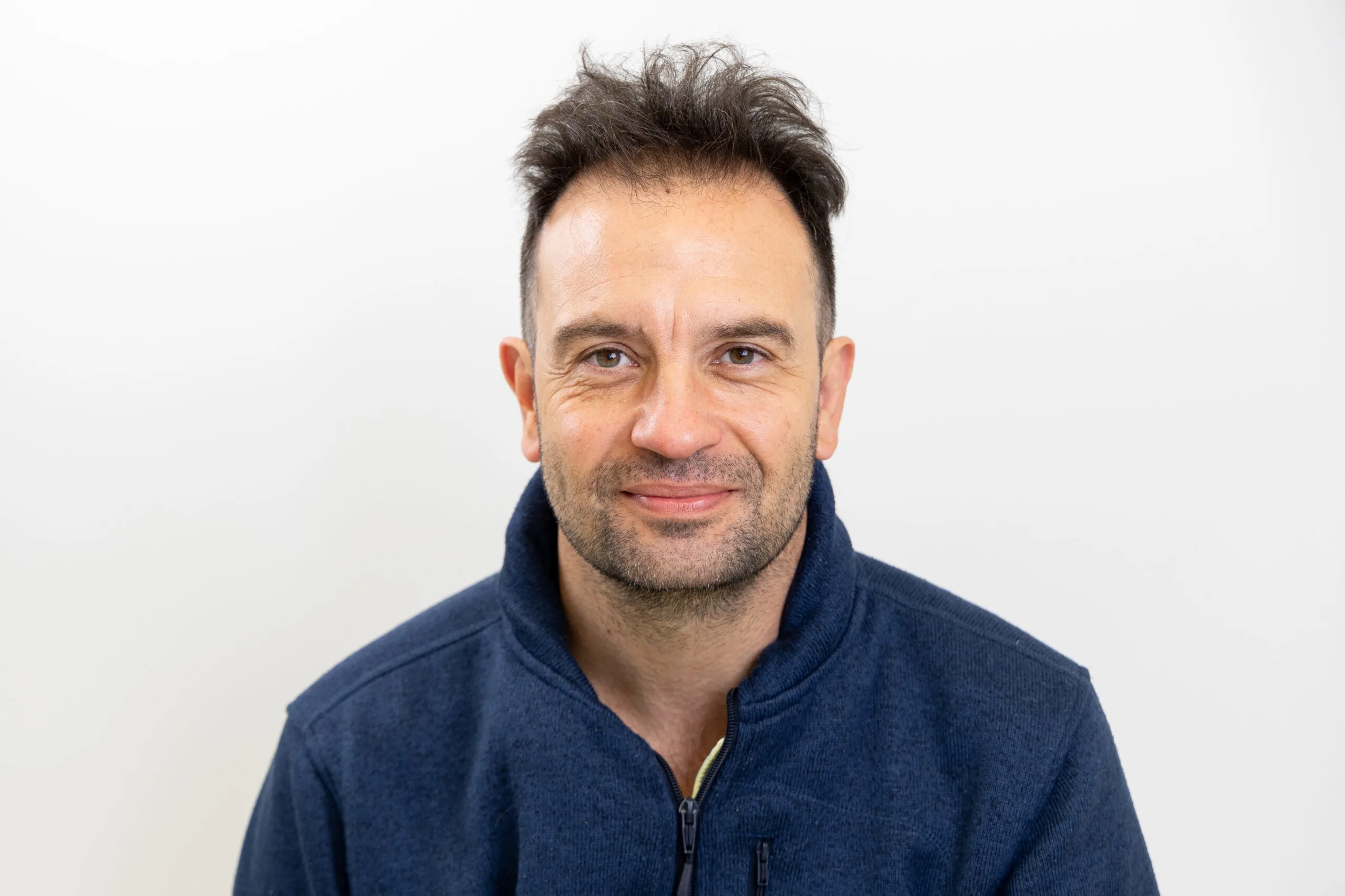 Jeroen Spitzenberger before his hair transplant, with visible coves and front hair loss.