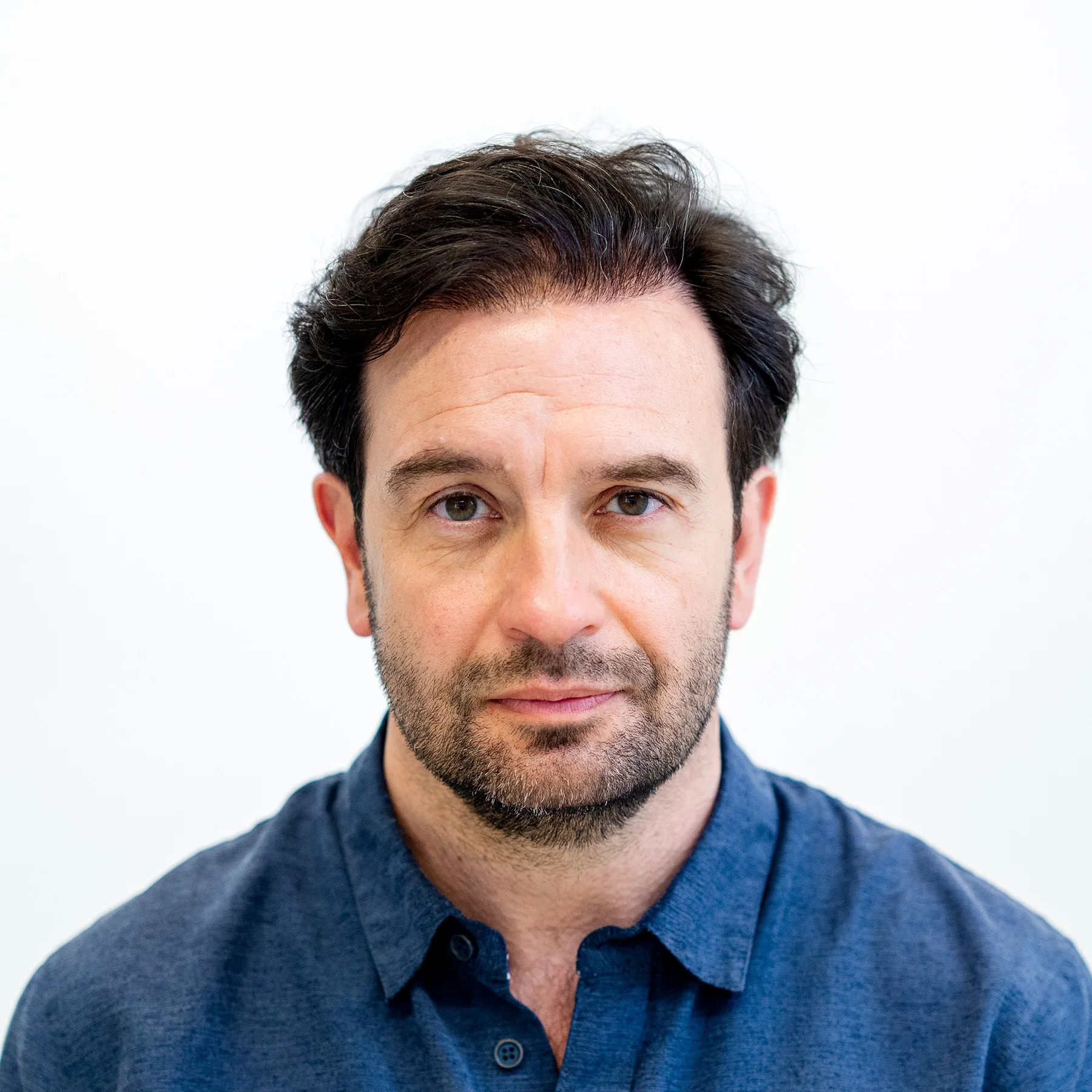 Man with dark hair and stubble looks straight into camera after hair transplant, wearing blue shirt.