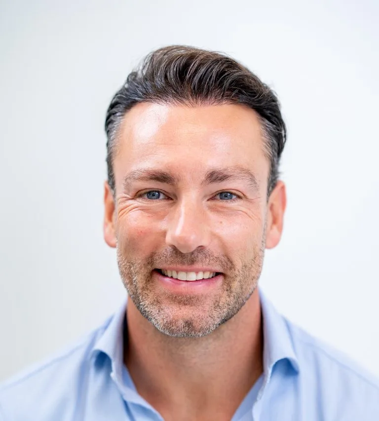 Frontal portrait of man after hair transplant, shows restored hairline and fuller hair growth